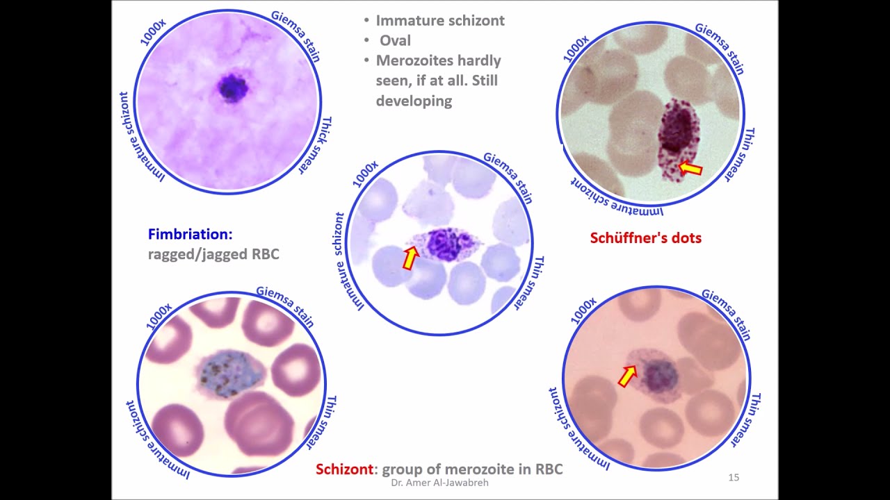 Plasmodium vivax ameboid trophozoites